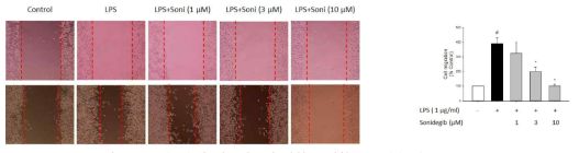 Sonidegib이 세포이동에 미치는 영향(wound healing assay)