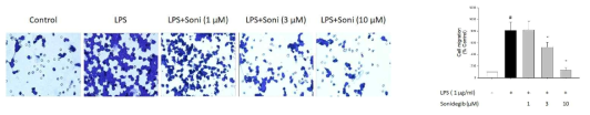 Sonidegib이 세포이동에 미치는 영향(transwell migration assay)