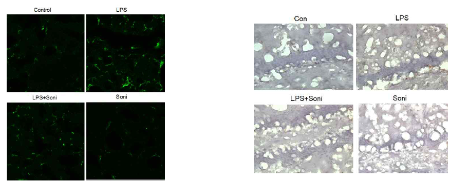생쥐에서 LPS주사로 유도한 미세아교세포의 이동에 대한 sonidegib의 영향: 형광이미지(좌) 및 DAB 염색(우)