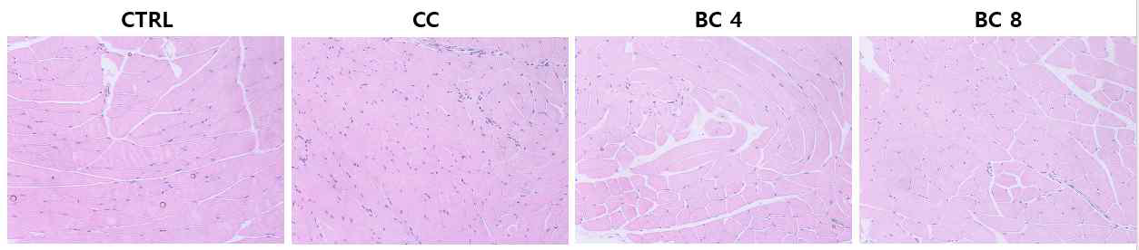 Effects of β-carotene on the sizes of muscle fiber in gastrocnemius muscle of LLC-induced cancer cachexia mouse model. Representative images of H BC, β-carotene; BC 4, BC 4 mg/kg b.w. supplementation; BC 8, BC 8 mg/kg b.w. supplementation