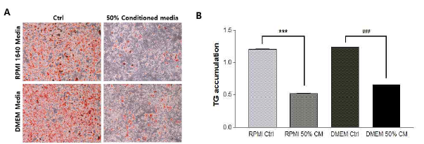 Effects of CT26 conditioned media on adipogenesis in 3T3-L1 cells. After CT26 colon cancer cells were grown in RPMI 1640 or DMEM media, the conditioned media were collected. They were treated to 3T3-L1 cells during adipocyte differentiation for 6 days. (A) Adipogenesis was assayed with Oil Red O staining. (B) The absorbance of the extracted Oil Red O was measured at 570 nm to determine the triglyceride (TG) accumulation. CM, conditioned media. ***P < 0.001 compared to the RPMI Ctrl group. ###P < 0.001 compared to the DMEM Ctrl group