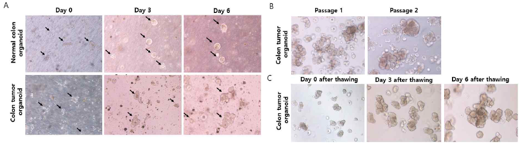 Patient-derived normal colon and colon tumor organoid cultures. (A) Normal colon and colon tumor organoids on day 0, 3, 6 after isolation and (B) colon tumor organoid cultures after passaging and (B) freezing/thawing cycle