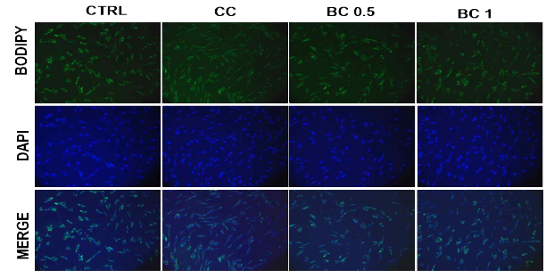 Effects of β-carotene on the adipogenesis in human primary preadipocyte co-cultured with colon cancer organoids. Human primary preadipocytes were stained with BODIPY 493/503 for visualizing lipids (green) and DAPI for visualizing nuclei (blue). CC, human primary preadipocyte co-cultured with colon cancer organoids; BC, β-carotene; BC 0.5, BC 0.5 uM ; BC 1, BC 1 uM