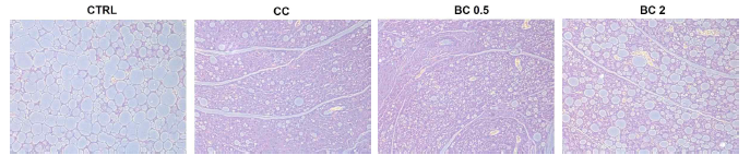 Effects of β-carotene on the number and sizes of adipocytes in subcutaneous fats of CT26-induced cancer cachexia mouse model. The representative images of H BC, β-carotene; BC 0.5, BC 0.5 mg/kg b.w. supplementation; BC 2, BC 2 mg/kg b.w. supplementation