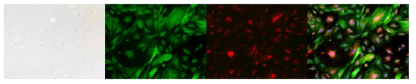 형광 발현 마우스로부터 채취 후 일차배양한 fibroblast (녹색: alpha SMA, 적색: dsRed)