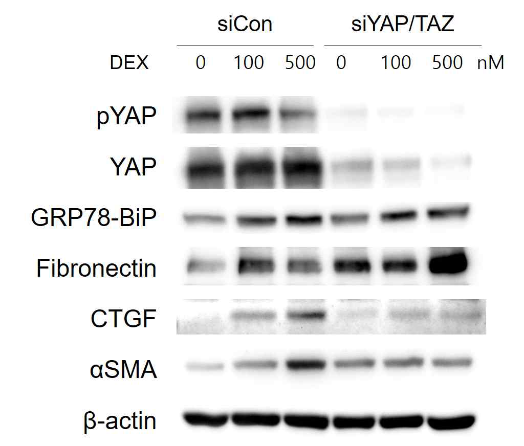 Dexamethasone 처리에 의한 섬유주세포의 YAP 의존적 섬유화 단백질의 발현 증가
