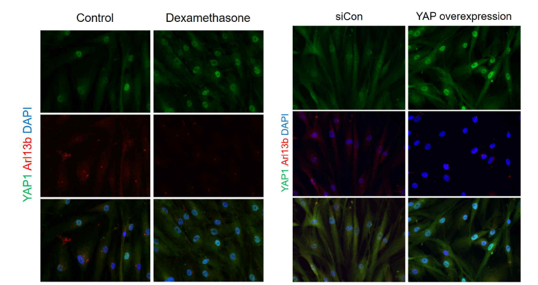 Dexamethasone 처리 및 YAP 과발현시 섬유주세포내 cilia 의 변화