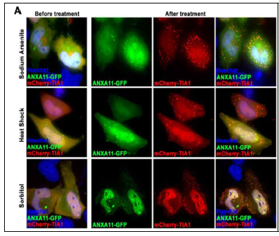 다양한 스트레스 조건에서 ANXA11 단백질과 RNA-단백질 응집체의 colocalization