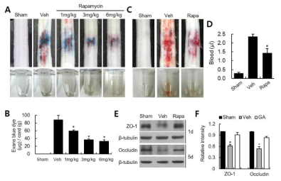 (A, B) Evans blue assay, (C, D) Hemorrhage assay, (E, F) Western blot for ZO-1, occludin