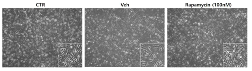 bEnd.3 cell에서 6시간 OGD후 vehicle과 rapamycin 처리한 세포의 phase-contrast image