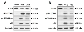 PTEN/mTOR pathway 활성에 미치는 TRPM7 inhibitor carvacrol (CAR)과 PDGFR inhibitor glivec (Gli)의 영향 (Western blot)