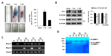 척수혈관장벽 손상에 미치는 TRPM7의 영향. (A) Evans blue assay, (B) Western blot for ZO-1, occludin, (C) RT-PCR for MMP-2, MMP-9, (D) Zymography for MMP-2, MMP-9