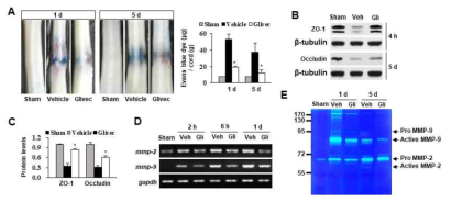 척수혈관장벽 손상에 미치는 PDGF receptor signaling 영향. (A) Evans blue assay, (B-C) Western blot for ZO-1, occludin (D) RT-PCR for MMP-2, -9 (E) Zymography for MMP-2,-9