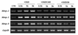 bEnd.3 세포에서 OGD후 TRPM7과 PDGF receptor siganling이 MMP-2, MMP-3, MMP-9에 미치는 영향 확인 (RT-PCR)