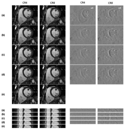 Reconstructed images (upper) and line profiles (lower) by various methods at compression ratios (CR) of 4 and 8. Error images are shown in right side. (a) Linear interpolation, (b) NN with SL (c) NN with TL, (d) NN with BTL, (e) ground truth image