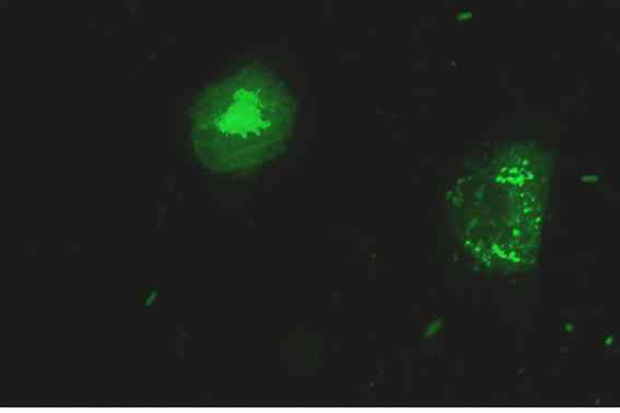 HDP 세포에 Drp7(DK5303) 화합물을 처리하였을 때의 미토콘드리아