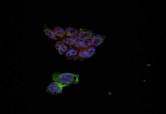 HaCaT 세포에서, control 상태의 미토콘드리아의 morphology 및 Drp1 단백질 분포