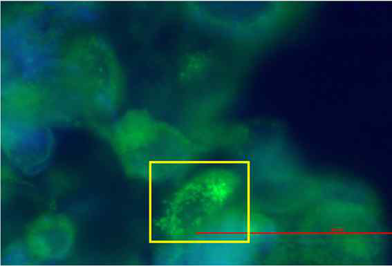 HaCaT 세포에 H2O2를 처리하여 ROS를 유발시켜, 단편화된 미토콘드리아