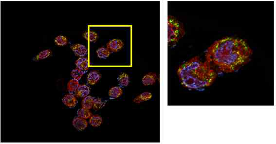 HaCaT 세포에 H2O2 및 Drp7(DK5303) 화합물을 처리한 결과로, 이어져있는 미토콘드리아 및 Drp1 단백질 확인