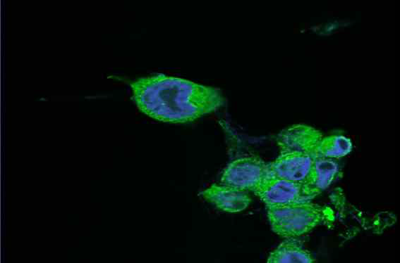 HaCaT 세포에 Drp7(DK5303) 화합물을 처리하였을 때의 미토콘드리아