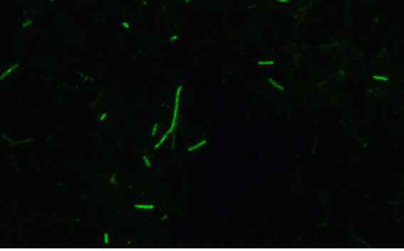 HDP 세포의 control 상태의 기다란 모양의 미토콘드리아