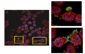 HaCaT 세포에 H2O2를 처리하여 ROS를 유발시킨 미토콘드리아 및 Drp1 단백질 분포