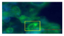 HaCaT 세포에서, H2O2를 처리하여 ROS를 유발시켜, 단편화된 미토콘드리아
