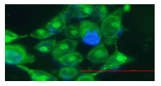 HaCaT 세포에서, 화합물(M1)을 처리했을 때 미토콘드리아