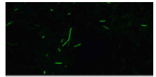 HDP 세포에서, control 상태의 기다란 모양의 미토콘드리아