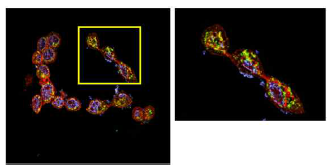 HaCaT 세포에 H2O2 및 화합물(M1)을 처리한 이어져 있는 미토콘드리아 및 Drp1 단백질 분포
