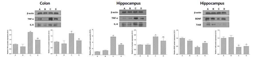 Tumor necrosis factor (TNF)-α and Interleukin (IL)-6 expressions, and brain-derived neurotrophic factor and TrkB. A, control group; B, control and treadmill exercise group; C, IBD-induced group; D, IBD and treadmill exercise group. Data are expressed as the mean±standard error of the mean. *P<0.05 compared to control group. #P<0.05 compared to IBD group