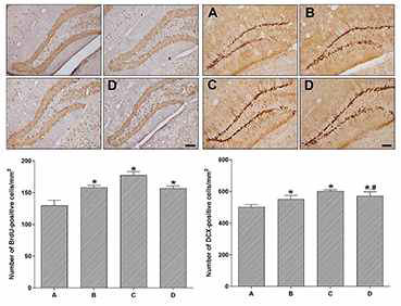 The effect of treadmill exercise on BrdU (left) and DCX (Right). A, control group; B, low-intensity exercise group; C, moderate-intensity exercise group; D, high-intensity exercise group. Data are expressed as the mean±standard error of the mean.#P<0.05 compared to stress group