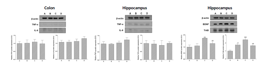 Tumor necrosis factor (TNF)-α and Interleukin (IL)-6 expressions, and brain-derived neurotrophic factor and TrkB. A, control group; B, low-intensity exercise group; C, moderate-intensity exercise group; D, high-intensity exercise group. Data are expressed as the mean±standard error of the mean. #P<0.05 compared to control group. #P<0.05 compared to low-intensity exercise group. ∮P<0.05 compared to moderate-intensity exercise group