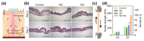 산소 방출 하이드로젤의 (a) 마우스 절개 모델을 통한 조직 재구성 평가 모식도 및 (b) Masson’s trichrome 염색 결과. (c) 만능재료시험기 (UTM)을 통한 재생된 조직의 조직 인장 강도 측정 모식도 및 (d) 정량 결과