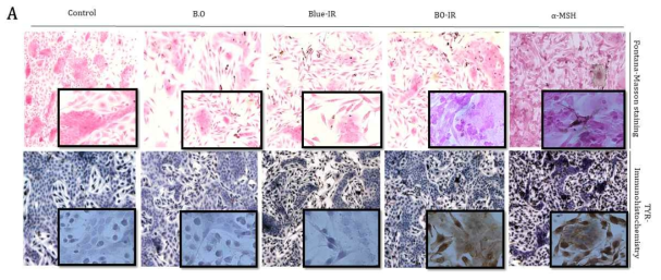 Investigation of melanin transport mechanism in co-culture models. The initial seeding ratio of keratinocytes to melanocytes was 5:1. The cells were then stained (A) Fontana-Masson staining (upper panels) and TYR-immunohistochemistry (lower panels) observed by microscopy with low magnification (X 200) and high magnification (X 400)