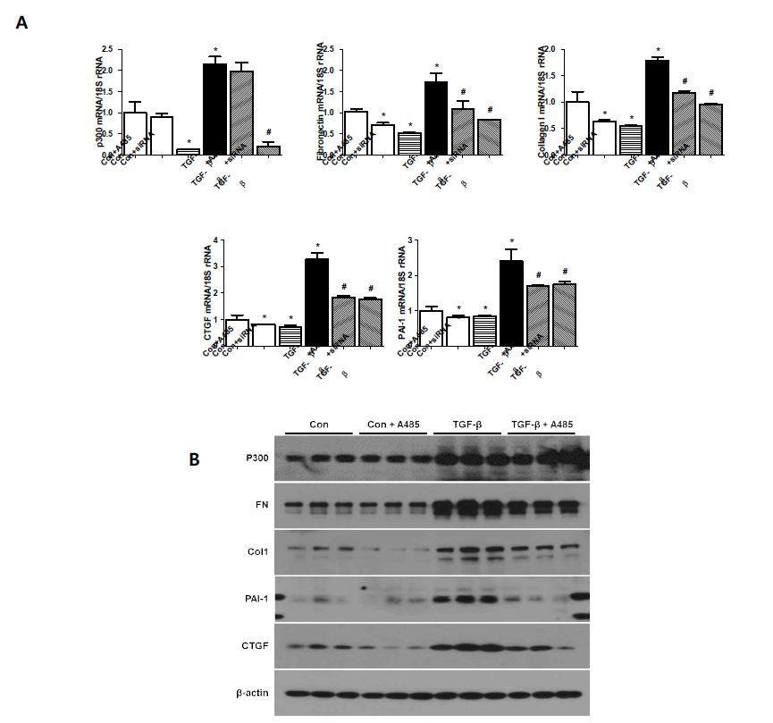 histone acetyltransferase p300의 활성화를 억제하였을 때의 섬유화 단백의 발현 변화 분석
