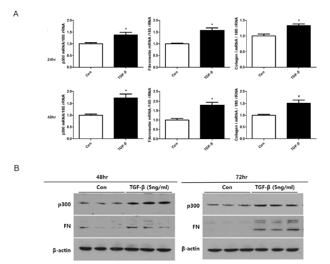 당뇨 환경 하에서 histone acetyltransferase p300의 활성화와 이에 의한 섬유화 관련 마커의 발현 변화. A. qPCR로 확인한 mRNA 양상 변화, B. western blot으로 확인한 단백 양상 변화