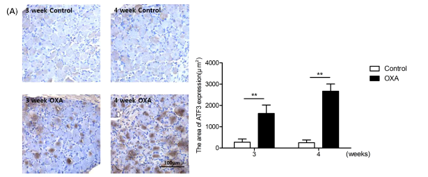 Immunohistochemical staining of ATF3 in DRG. Expression of ATF3 in DRG of control and OXA group (A). Scale bars = 100㎛. The area of ATF3 expression (B)