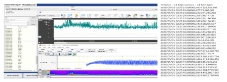 뇌파(EEG)감시 장치 뇌파 data (좌) 및 추출된 CSV data (우)