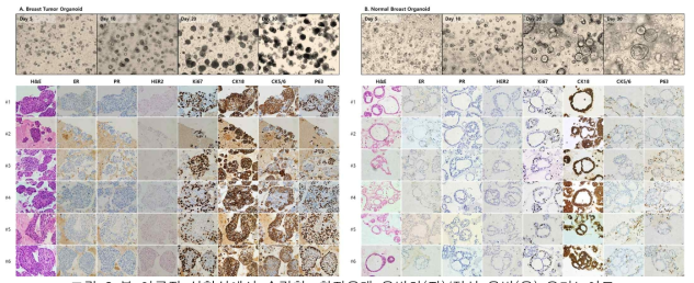 본 연구진 실험실에서 수립한, 환자유래 유방암(좌)/정상 유방(우) 오가노이드 위) Bright-field Images, 아래) H&E, ER, PR, HER2, Ki67, CK18, CK5/6 and P63 on day30