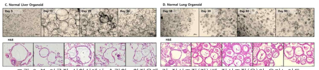 본 연구진 실험실에서 수립한, 환자유래 간 정상조직(좌)/폐 정상조직(우)의 오가노이드