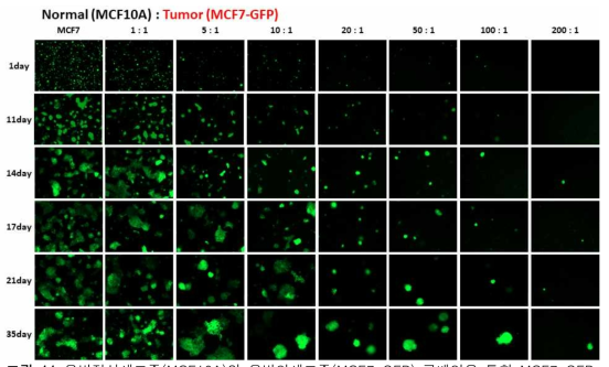 유방정상세포주(MCF10A)와 유방암세포주(MCF7-GFP) 공배양을 통한 MCF7-GFP 형광사진