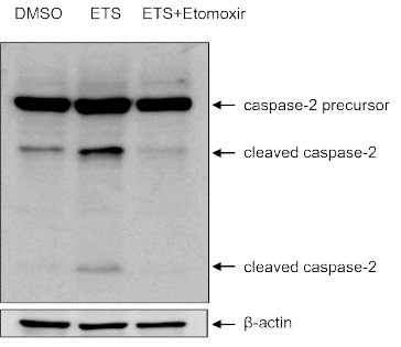 FAO에 의한 Caspase2의 활성조절