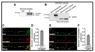 NHE6 및 SCAMP5 단백질의 발현위치 및 상호작용 확인