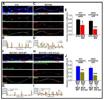 SCAMP5 KD 뉴런에서 나타나는 NHE6 발현 위치 이상 및 회복