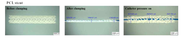 폴리머 스텐트 풍성 카테터 팽창 테스트