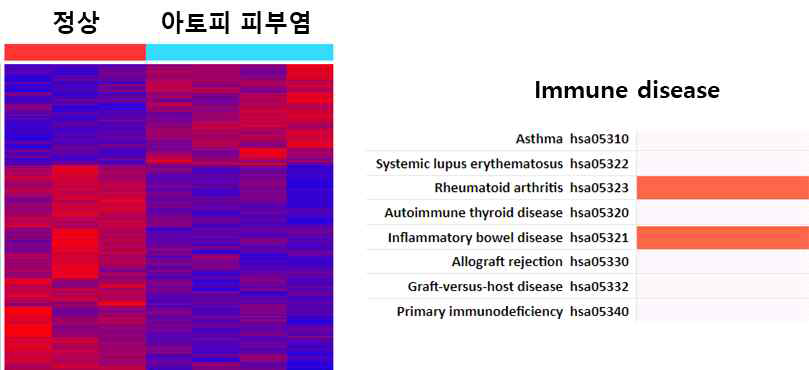 아토피 피부염 환자에서 염증성 장질환 연관 유전자 과발현