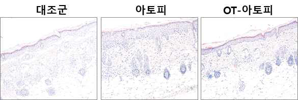 수정 경피감작 모델의 피부 조직 분석