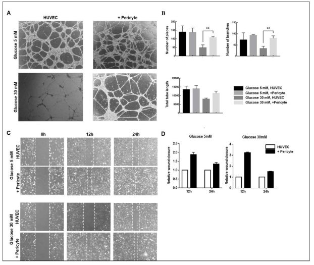 고혈당 조건에서 pericyte에 의한 tube formation 및 migration 검증