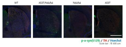 A53T/Ndufs4 결합모델의 nigra-striatal pathway 감소 및 a-syn 인산화 증가